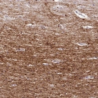 Immunohistochemical staining of human cerebral cortex shows strong positivity in neuronal processes in neuropil.