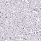 Immunohistochemical staining of human liver shows no positivity in hepatocytes as expected.
