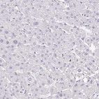 Immunohistochemical staining of human liver shows no positivity in hepatocytes as expected.