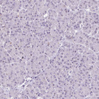 Immunohistochemical staining of human pancreas shows no positivity in exocrine glandular cells as expected.