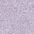 Anti-CMTM5 Antibody