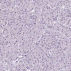Immunohistochemical staining of human pancreas shows no positivity in exocrine glandular cells as expected.
