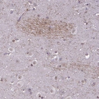 Anti-GLRB Antibody