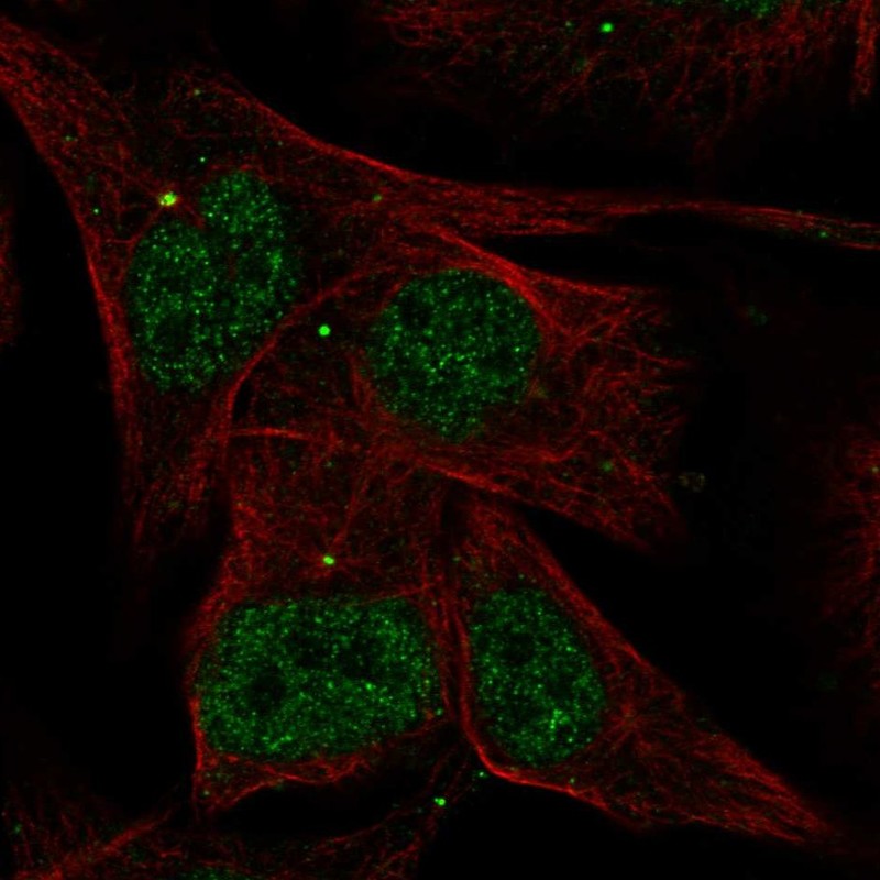 Anti-AKNA Antibody