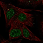 Anti-AKNA Antibody