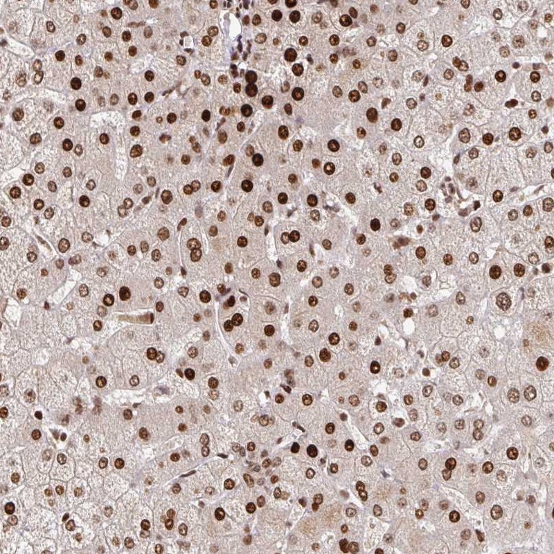 Anti-PDE1C Antibody
