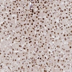 Anti-PDE1C Antibody