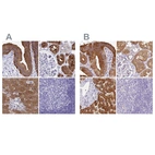 Immunohistochemical staining of human gallbladder, kidney, liver and tonsil using Anti-HGD antibody HPA052359 (A) shows similar protein distribution across tissues to independent antibody HPA047374 (B).