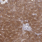 Immunohistochemical staining of human liver shows high expression.
