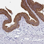 Immunohistochemical staining of human gallbladder shows strong cytoplasmic positivity in glandular cells.