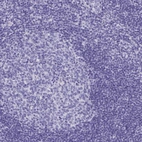 Immunohistochemical staining of human tonsil shows low expression as expected.