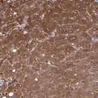 Immunohistochemical staining of human liver shows strong cytoplasmic positivity in hepatocytes.