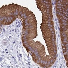 Immunohistochemical staining of human gallbladder using Anti-HGD antibody HPA052359.