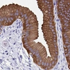 Immunohistochemical staining of human gallbladder using Anti-HGD antibody HPA052359.