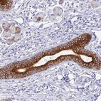 Immunohistochemical staining of human salivary gland shows strong cytoplasmic positivity in glandular cells.