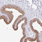 Immunohistochemical staining of human gallbladder shows strong cytoplasmic positivity in glandular cells.