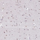 Anti-UTP18 Antibody