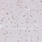 Anti-UTP18 Antibody