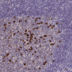 Anti-CD38 Antibody