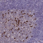 Immunohistochemical staining of human lymph node shows strong membranous positivity in lymphoid cells.