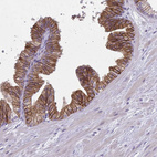 Anti-CD38 Antibody