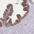 Immunohistochemical staining of human prostate shows strong membranous positivity in glandular cells.