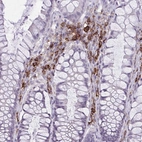 Immunohistochemical staining of human rectum shows strong membranous positivity in lymphoid cells.