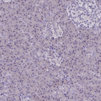 Anti-CD38 Antibody