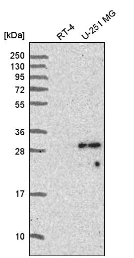 Anti-SPAG7 Antibody