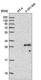 Anti-SPAG7 Antibody