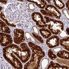 Anti-TRAPPC1 Antibody