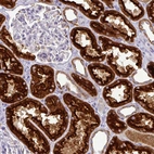 Anti-TRAPPC1 Antibody