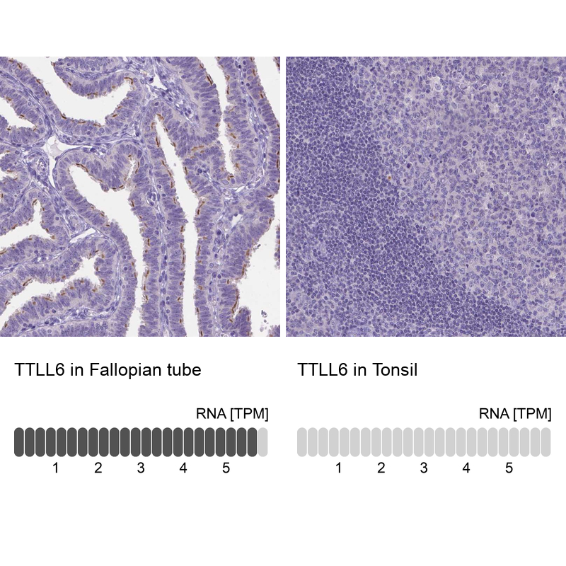 Anti-TTLL6 Antibody