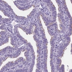 Immunohistochemical staining of human fallopian tube shows high expression.