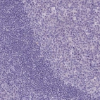 Immunohistochemical staining of human tonsil shows low expression as expected.