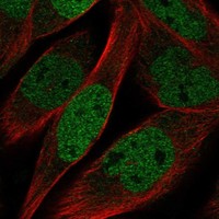 Anti-KLHL11 Antibody