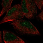 Anti-AMZ2 Antibody