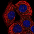 Immunofluorescent staining of human cell line A-431 shows localization to vesicles.