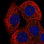 Immunofluorescent staining of human cell line A-431 shows localization to vesicles.