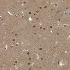 Immunohistochemical staining of human cerebral cortex shows moderate nuclear positivity in neurons.