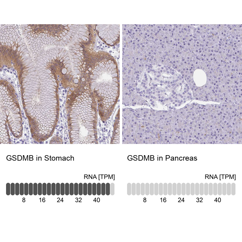 Anti-GSDMB Antibody