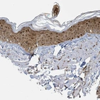 Immunohistochemical staining of human skin shows moderate nuclear positivity in epidermal cells.