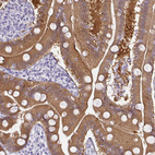 Immunohistochemical staining of human duodenum shows moderate cytoplasmic positivity in glandular cells.