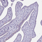 Immunohistochemical staining of human Fallopian tube shows no positivity in glandular cells as expected.
