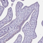 Immunohistochemical staining of human Fallopian tube shows no positivity in glandular cells as expected.