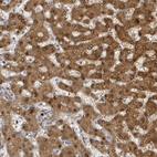 Immunohistochemical staining of human liver shows positivity in hepatocytes.