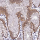 Immunohistochemical staining of human stomach shows moderate cytoplasmic positivity in glandular cells.
