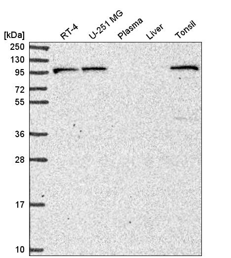 Anti-PIK3R5 Antibody