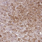 Anti-SRGAP1 Antibody
