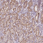 Anti-ZNF615 Antibody